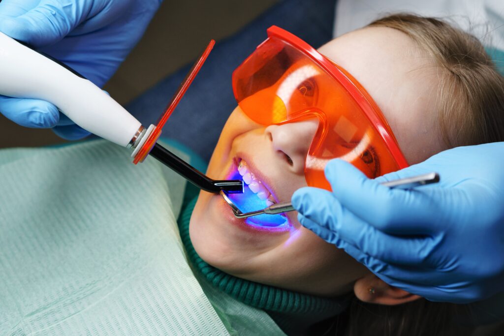 dental fillings kitchener