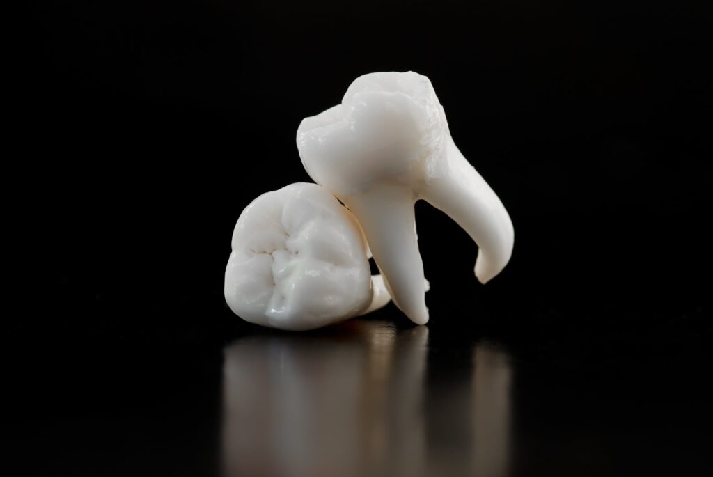 wisdom tooth extraction near me