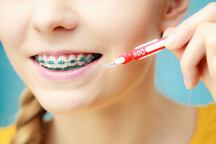 christmas tree brush for braces
