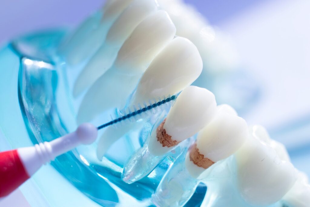 small toothbrush for between teeth
